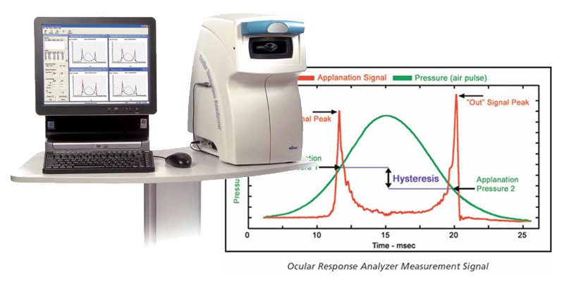 Ocular Response Analyzer - ORA